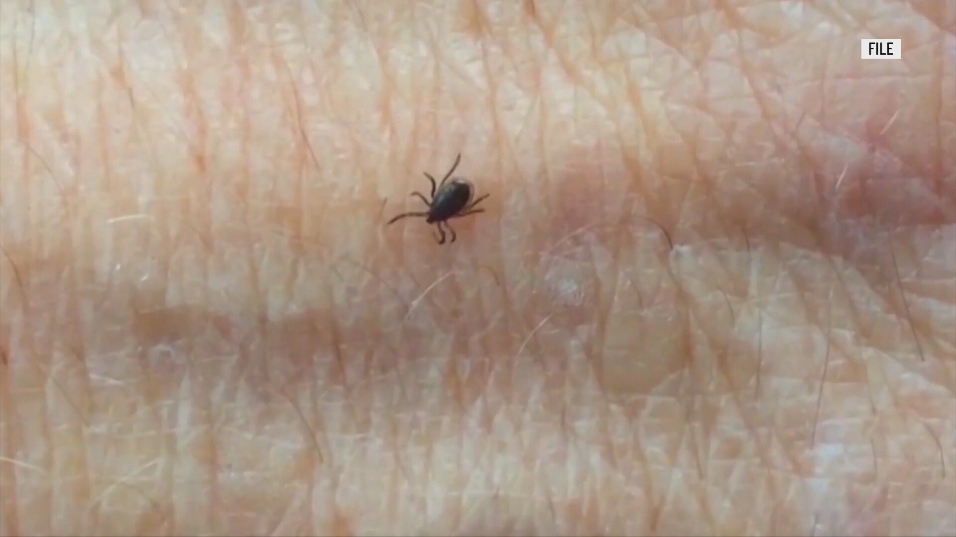 Expert says what to expect, how to stay safe during tick season - Vimarsana News